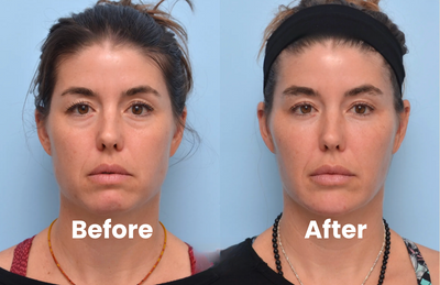 Transformation preview