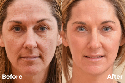 Transformation preview